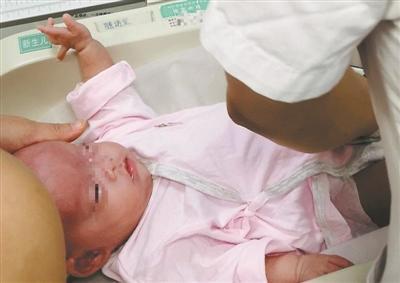 广州一540克超早产女婴奇迹存活 出生只有成人巴掌大