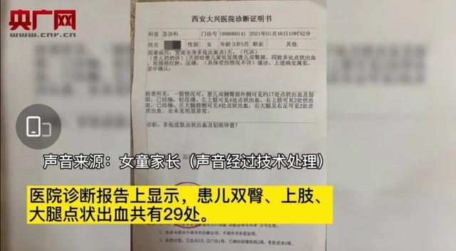 29个针眼！谁扎的？到底要怎么保护我们的孩子？