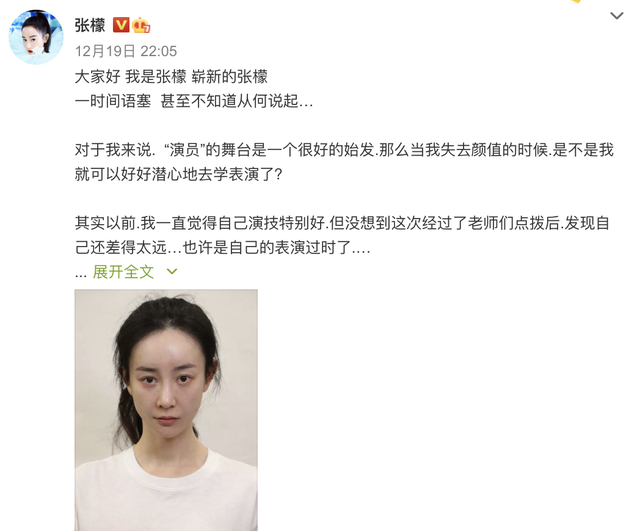 张檬晒全素颜照谈整容：失去了美貌，希望用演技再次征服大家