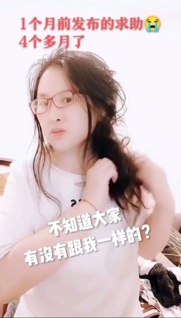 深圳一女子怕头秃3个月不洗头，结果悲剧了…如今全网发起求助
