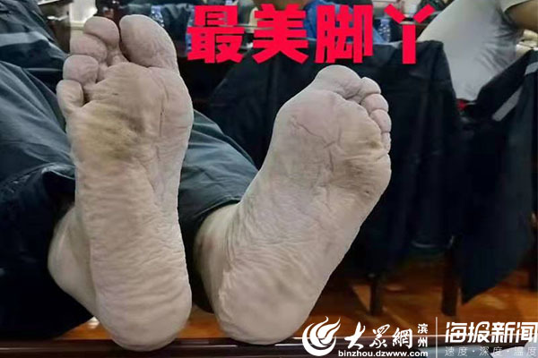 浸泡20小时！刷爆邹平朋友圈的“最美脚丫”主人公找到了