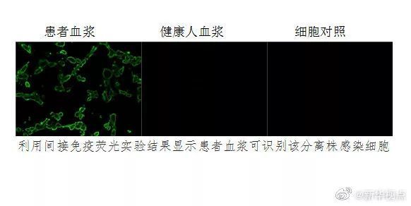 这件事，听他们怎么说！