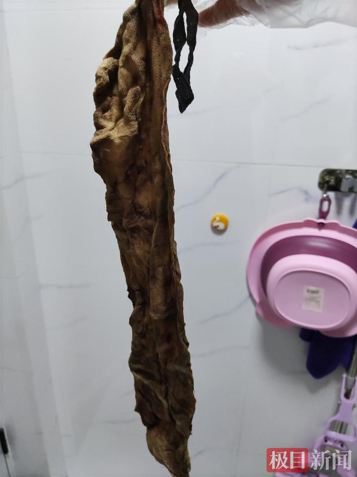 女子产后体内遗留纱布60天 南昌卫健委：助产士操作失误