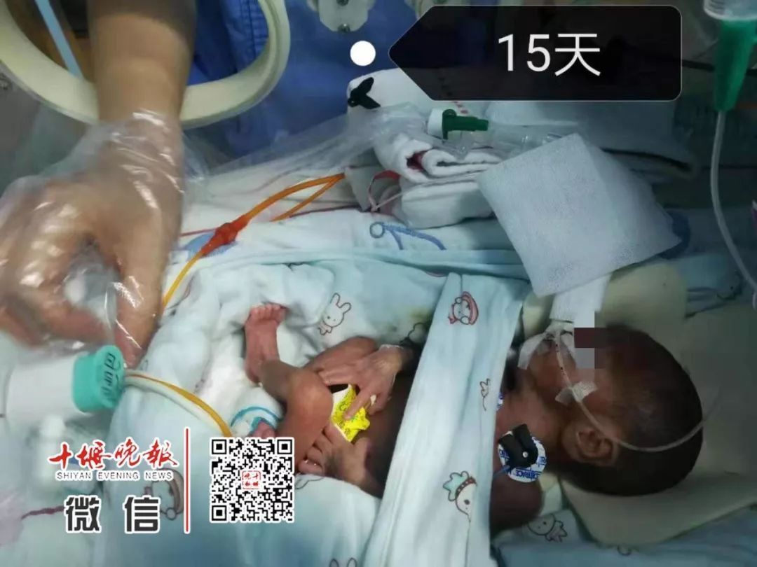 妈妈怀孕6个月产下巴掌大女婴！医生拍下14张照片，张张让人落泪……