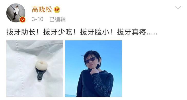 陆川曝高晓松瘦到单薄 剪短发变巴掌脸换了个人