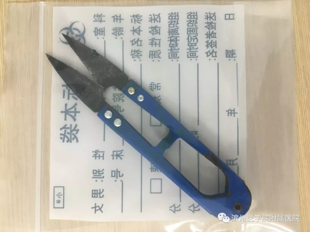 滨州一2多岁的小孩拿剪刀玩，不慎跌倒插入脑袋……