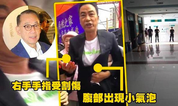 任达华已回港继续治疗，行凶者被拘受审，疑有精神病障碍