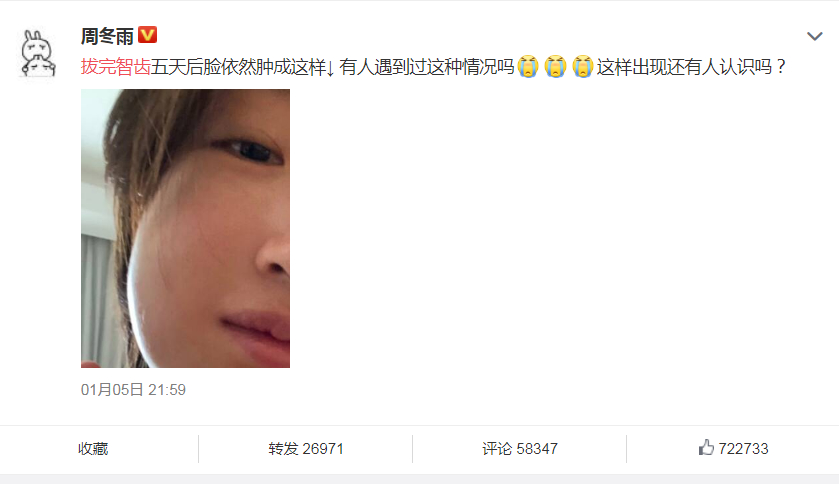 周冬雨戴口罩领奖 拔完智齿脸肿成包子 评论区炸了