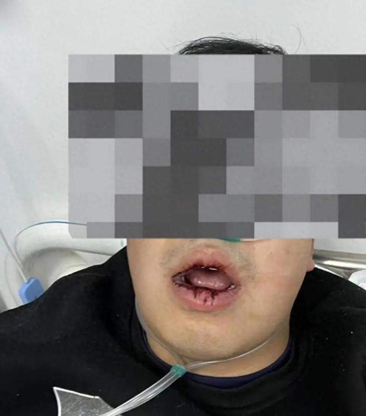 陕西男子在业主群骂物业被保安打上门？多方回应