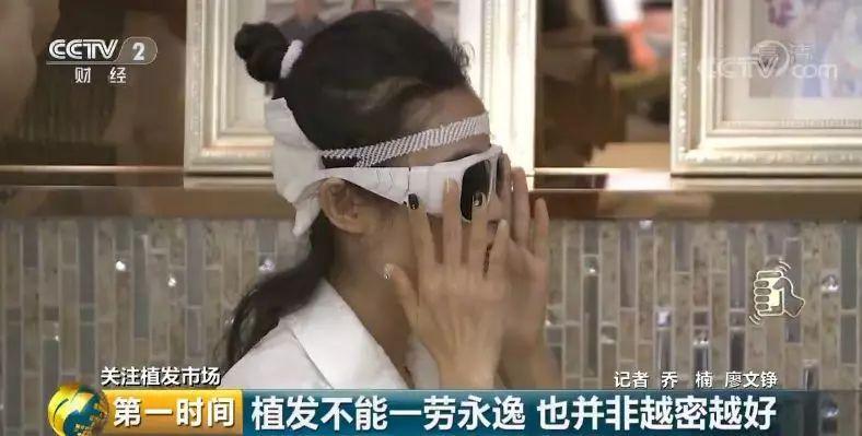 中国脱发人群超2.5亿 植发能否挽救“头顶大事”？