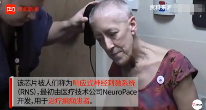 大脑中植入芯片减肥？外国科学家给过胖者植脑芯片：灭掉贪吃念头