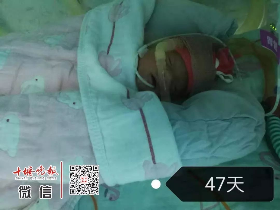 妈妈怀孕6个月产下巴掌大女婴！医生拍下14张照片，张张让人落泪……
