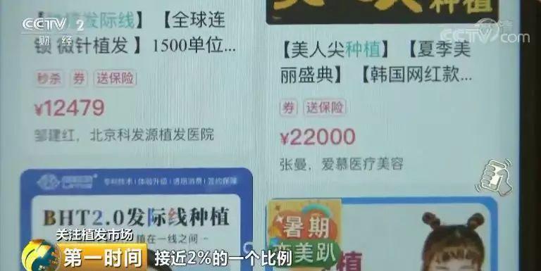 中国脱发人群超2.5亿 植发能否挽救“头顶大事”？