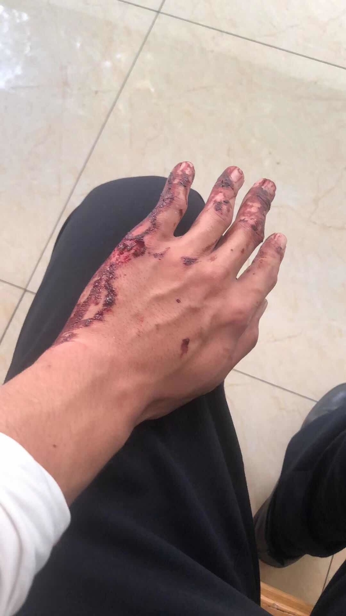 赞！烈日炎炎司机中暑，济南交警奋力砸窗救人！