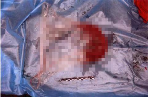 女子怀孕不知谁是孩子父亲，马桶生女掐死后弃尸垃圾桶被公诉