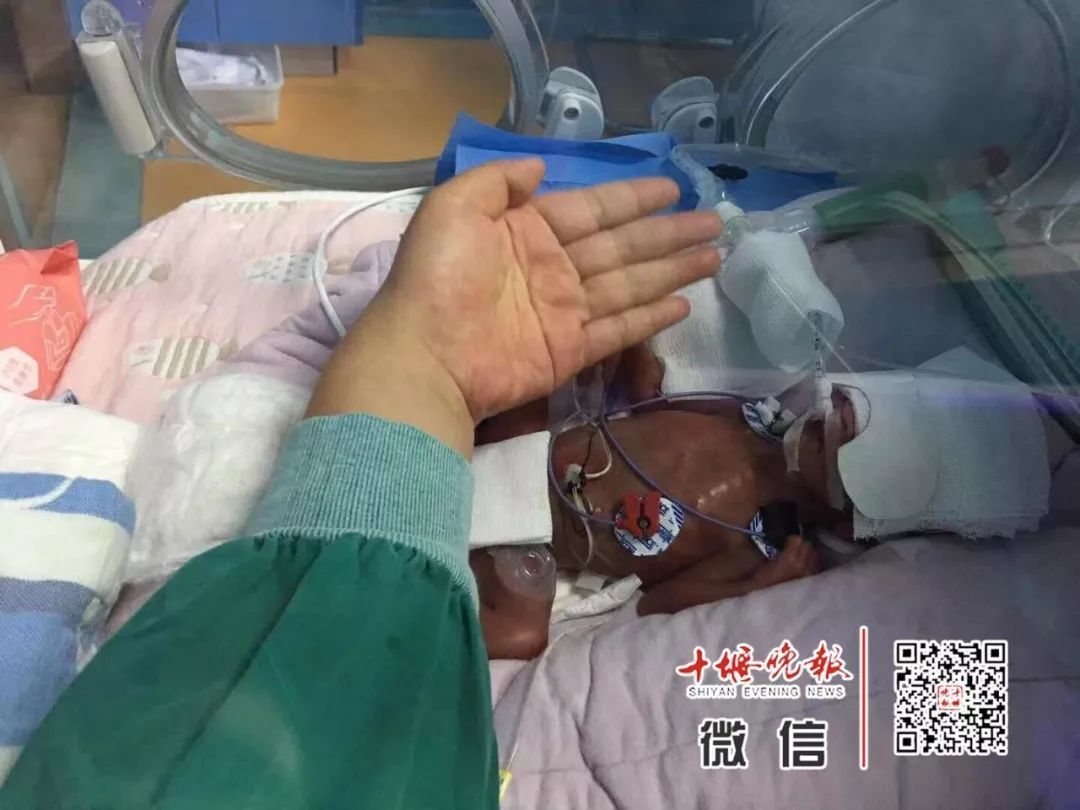 妈妈怀孕6个月产下巴掌大女婴！医生拍下14张照片，张张让人落泪……