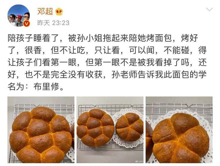 邓超孙俪爆笑日常 看见针灸模型有些不知所措