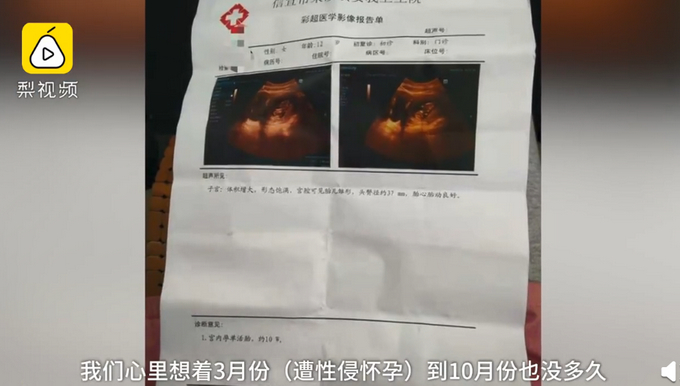 12岁智障女孩遭性侵，8个月内怀孕2次引关注，官方通报来了