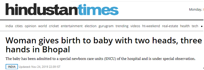 印度一女子生下“两头三手”男婴，曾被超声波检测怀双胞胎