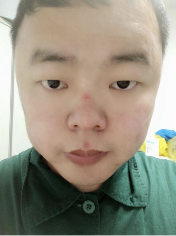 全民阻击丨心疼！没想到前方的你是这样的