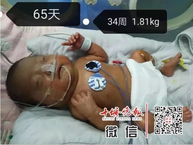 妈妈怀孕6个月产下巴掌大女婴！医生拍下14张照片，张张让人落泪……