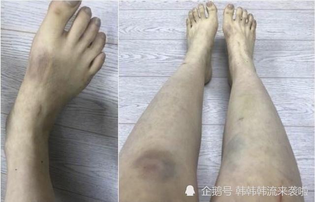 具荷拉前男友终审获刑1年|【吃瓜围观】具荷拉前男友终审获刑1年 非法拍摄罪名不成立