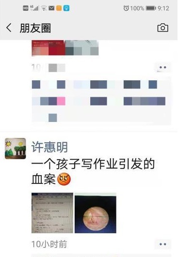 一个儿子写作业引发的血案 爸爸一巴掌甩过去：耳鼓膜穿孔...