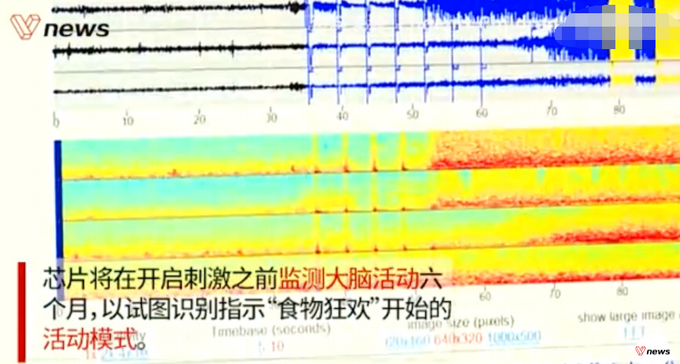 大脑中植入芯片减肥？外国科学家给过胖者植脑芯片：灭掉贪吃念头