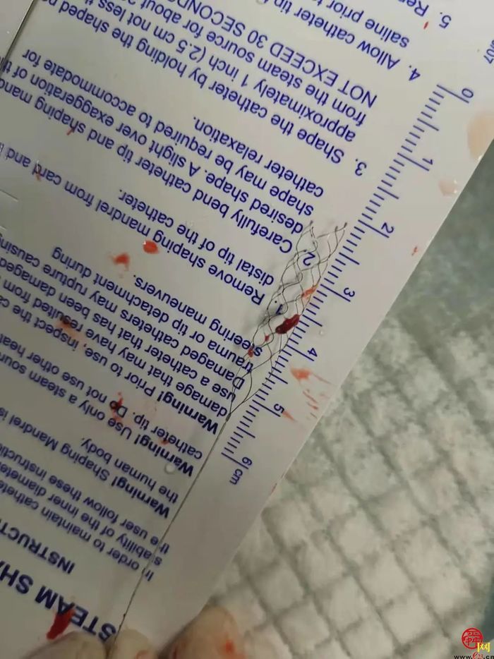 生死时速--溶栓取栓桥接治疗急性卒中