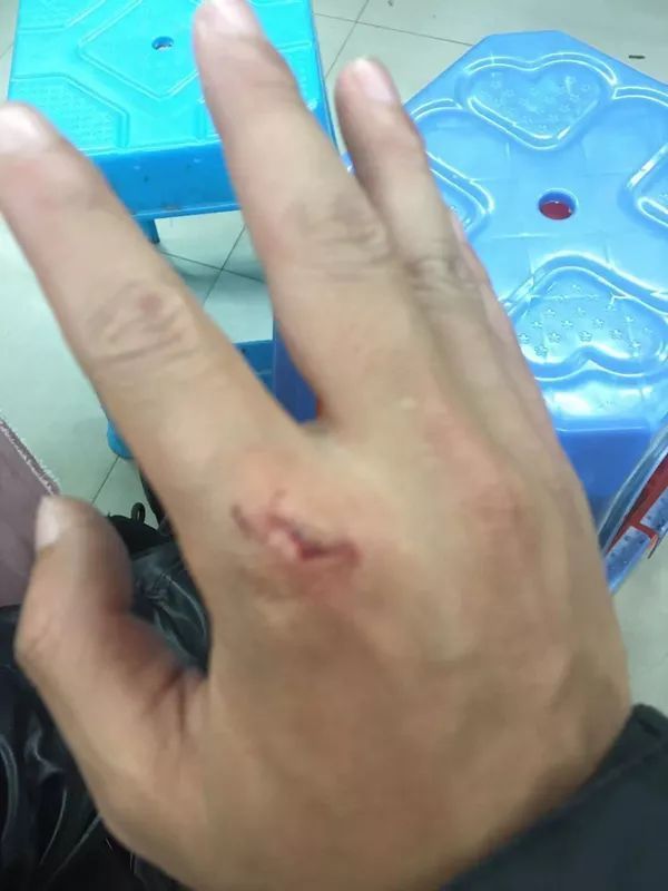 接到“两个不锈钢脸盆”订单！外卖小哥果断报警