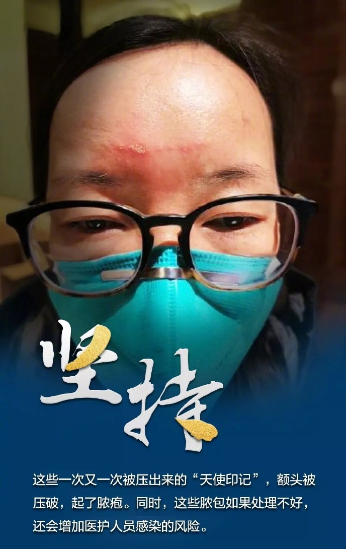 致敬看不见的医生：核酸检测医生双手被捂出红斑，忙到凌晨是常事
