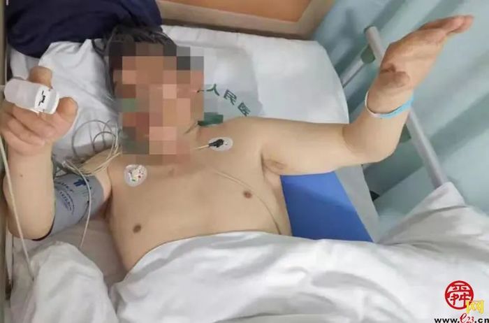 生死时速--溶栓取栓桥接治疗急性卒中