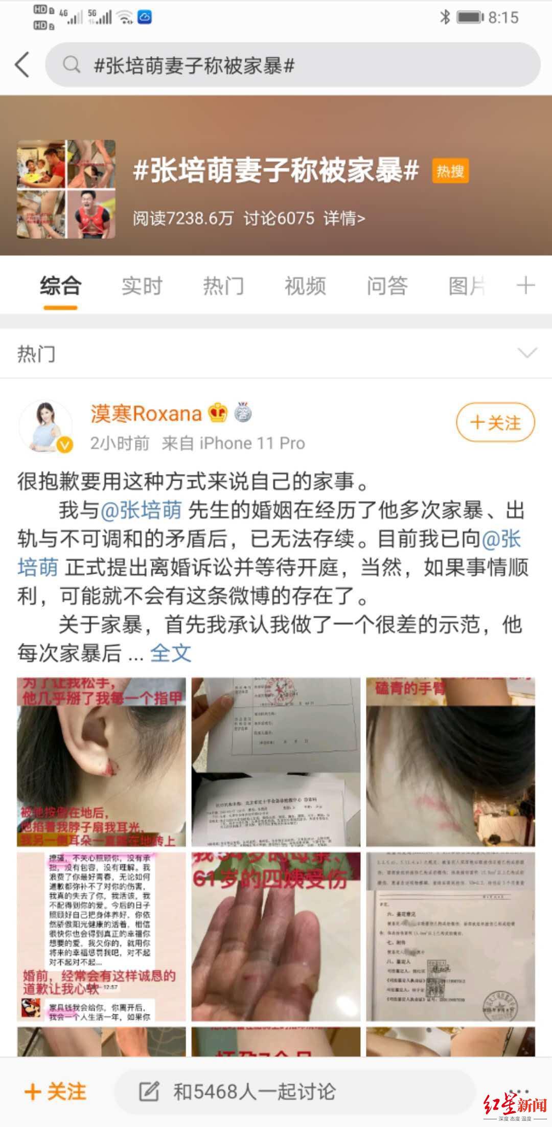 张培萌妻子称只想要女儿抚养权|【反转】张培萌妻子称只想要女儿抚养权 到底咋回事?