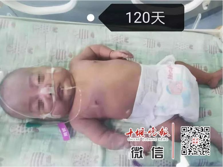 妈妈怀孕6个月产下巴掌大女婴！医生拍下14张照片，张张让人落泪……