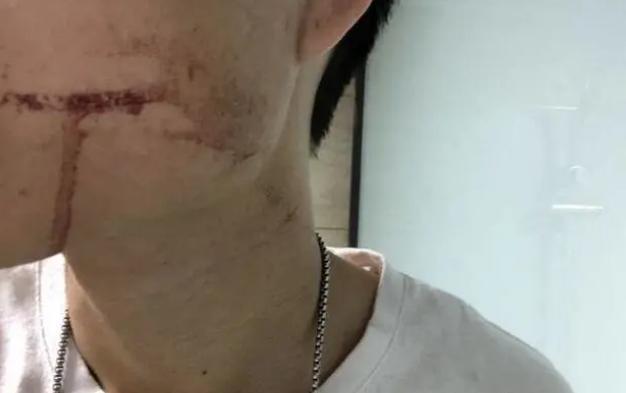 出社会以后-挂机方案【原形来了】小伙拔牙10天后脑出血殒命详细是怎么回事?变乱委曲详情曝光! ...挂机论坛(4)