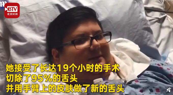 她竟感谢自己患口腔癌？切除95%舌头后暴瘦超450斤