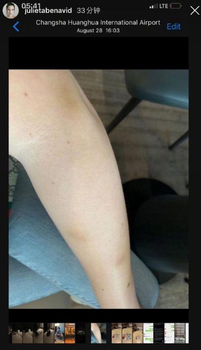 蒋劲夫前女友再发文，晒受伤照：如果想保留证据会被打的更凶！