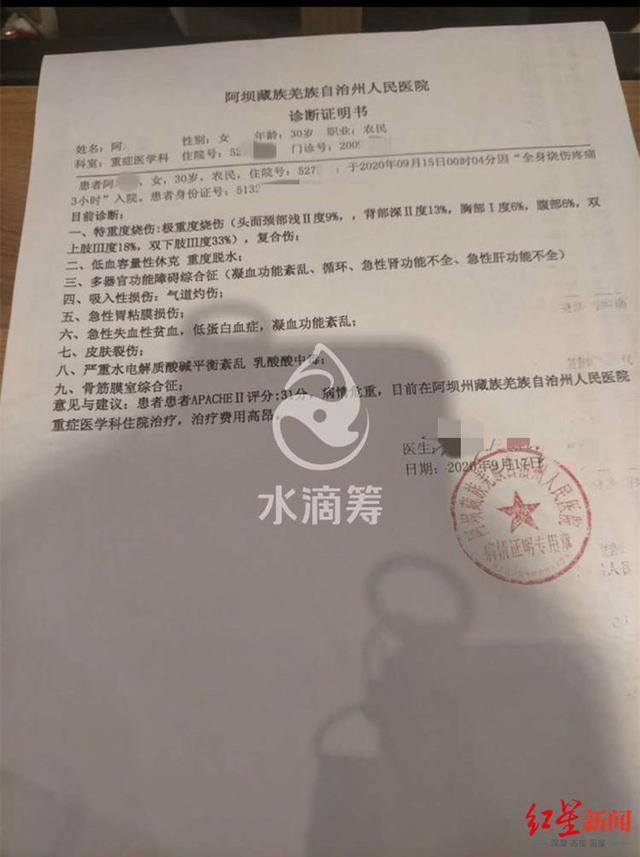 太吓人了!网红拉姆遭前夫纵火重度烧伤 什么仇什么怨竟下此狠手