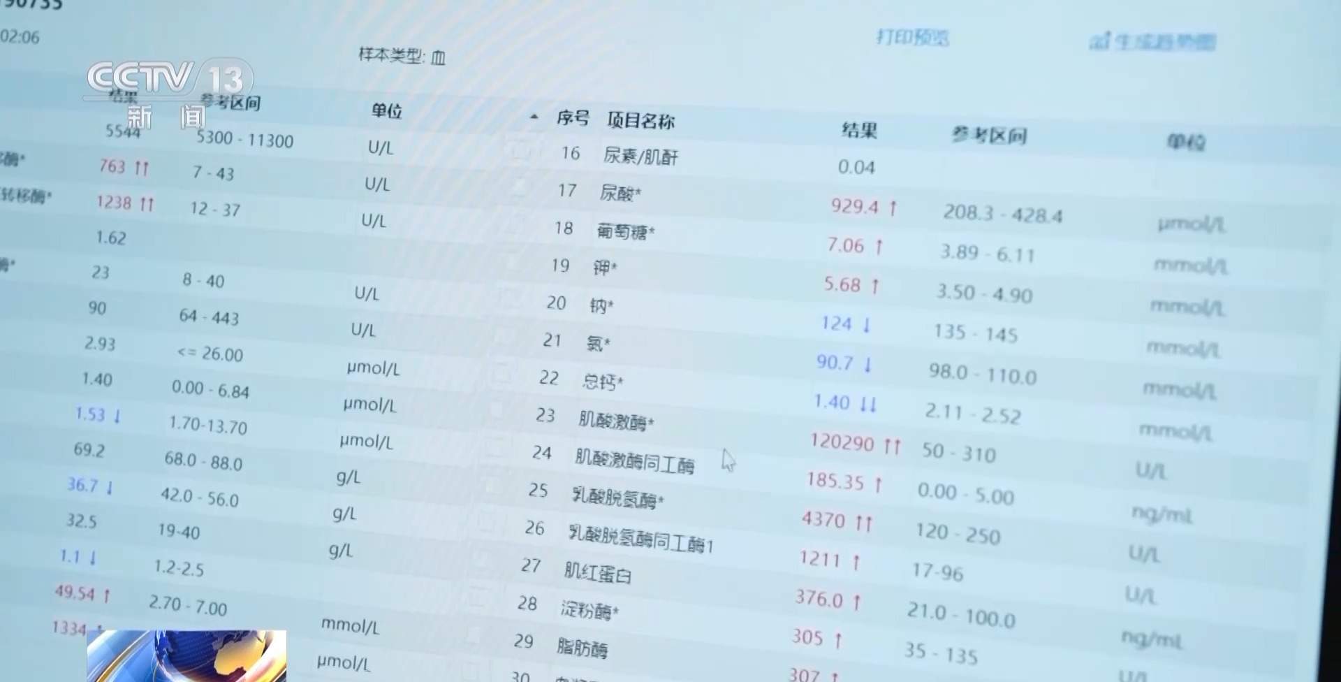 高中生连吃4种感冒药住进急诊重症监护室 医生提醒:吃药勿过量 勿“混搭”