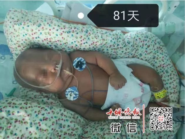 妈妈怀孕6个月产下巴掌大女婴！医生拍下14张照片，张张让人落泪……