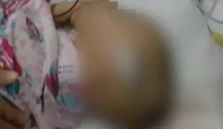 5岁女童被从天而降躺椅砸中 头骨开裂智力或受损