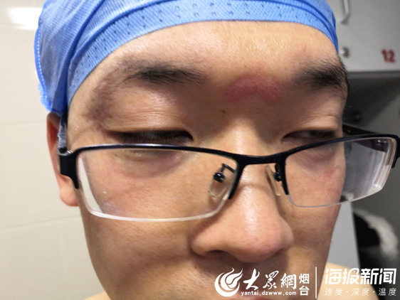 这就是山东丨医者手记：深深勒痕是我们的“战书”