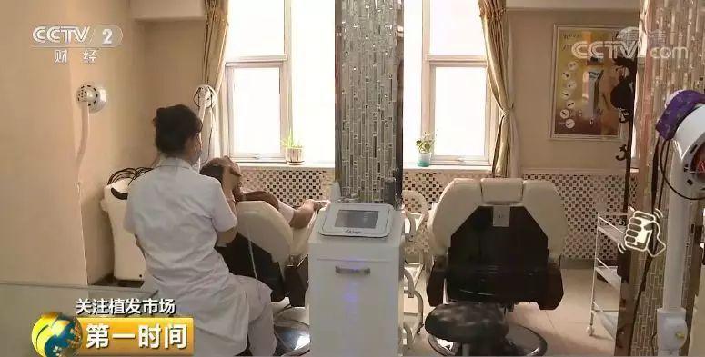 中国脱发人群超2.5亿 植发能否挽救“头顶大事”？