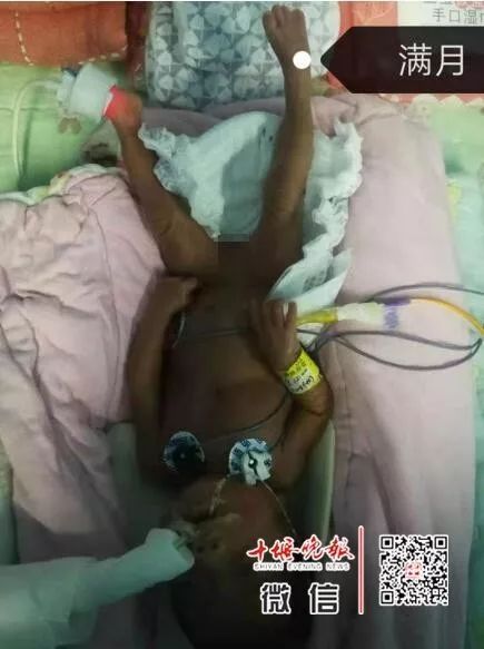 妈妈怀孕6个月产下巴掌大女婴！医生拍下14张照片，张张让人落泪……