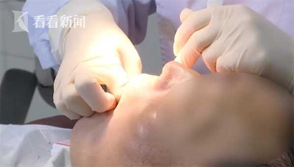 罕见！男子做假牙拍片意外发现鼻腔边长了颗牙(图)