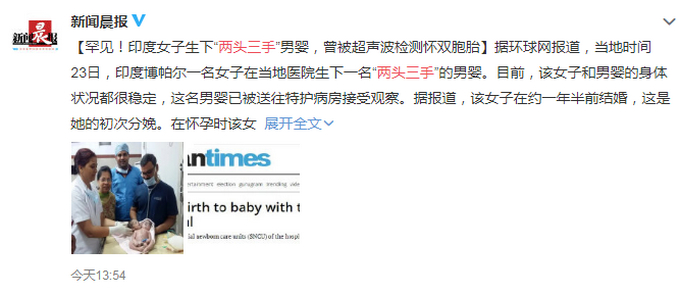 印度一女子生下“两头三手”男婴，曾被超声波检测怀双胞胎