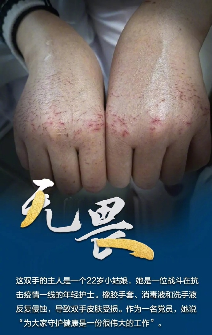 致敬看不见的医生：核酸检测医生双手被捂出红斑，忙到凌晨是常事