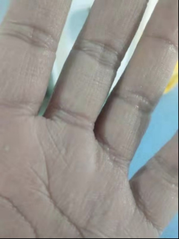 全民阻击丨心疼！没想到前方的你是这样的