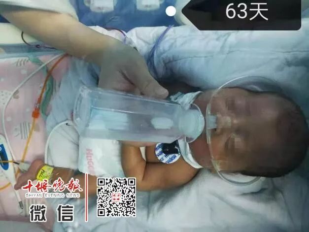 妈妈怀孕6个月产下巴掌大女婴！医生拍下14张照片，张张让人落泪……