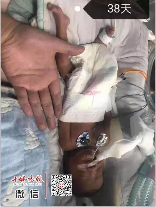 妈妈怀孕6个月产下巴掌大女婴！医生拍下14张照片，张张让人落泪……